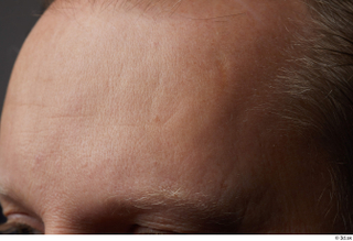 HD Face skin references Jameson Hahn eyebrow forehead skin pores…
